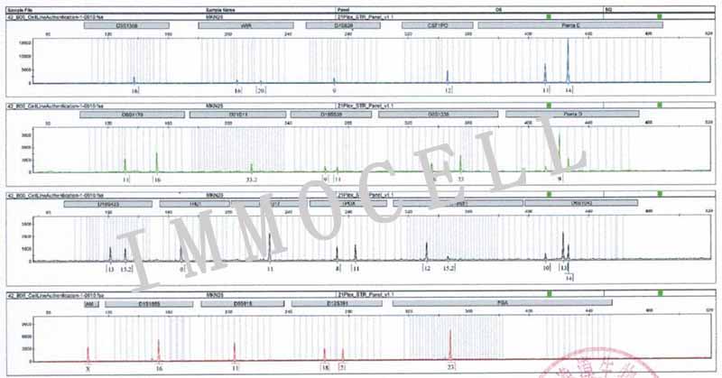 MKN-28人胃癌高转移细胞STR鉴定图片