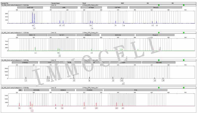MM.1S(人IgA-骨髓瘤细胞)STR鉴定图片