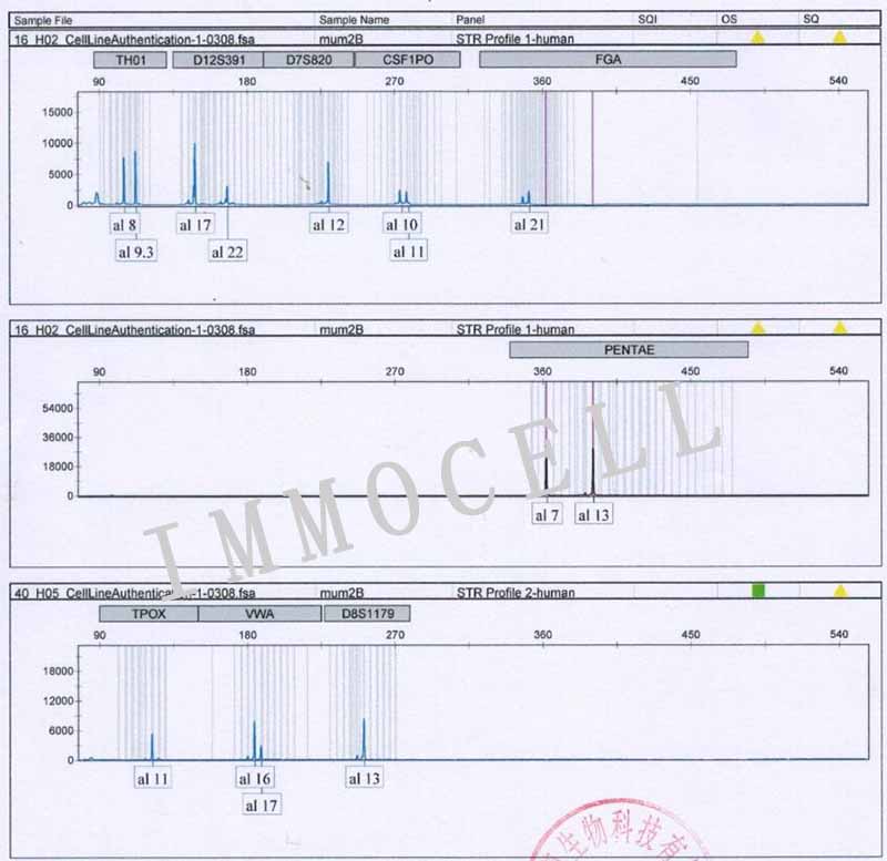 MUM2B人侵袭性脉络膜黑色素瘤细胞STR鉴定图片