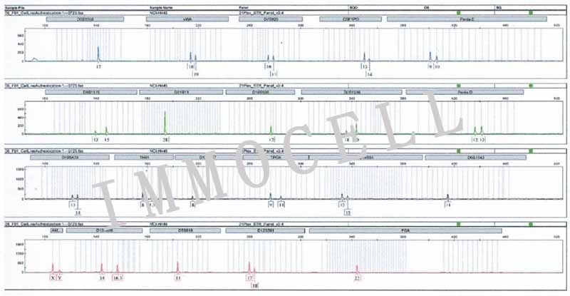 NCI-H446人小细胞肺癌细胞STR鉴定图片