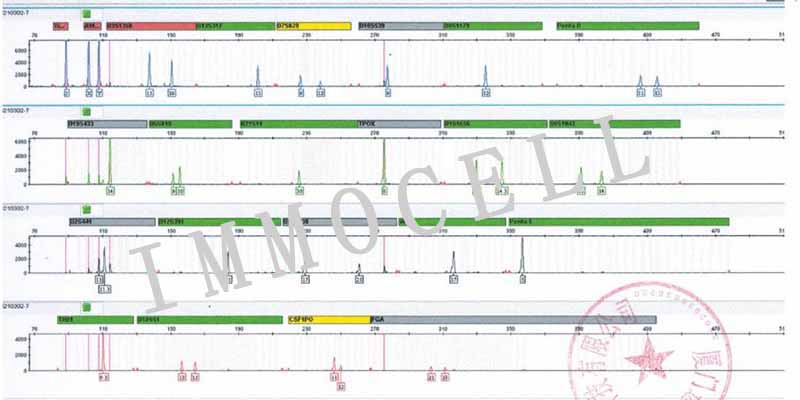 NCI-H460人大细胞肺癌细胞STR鉴定图片