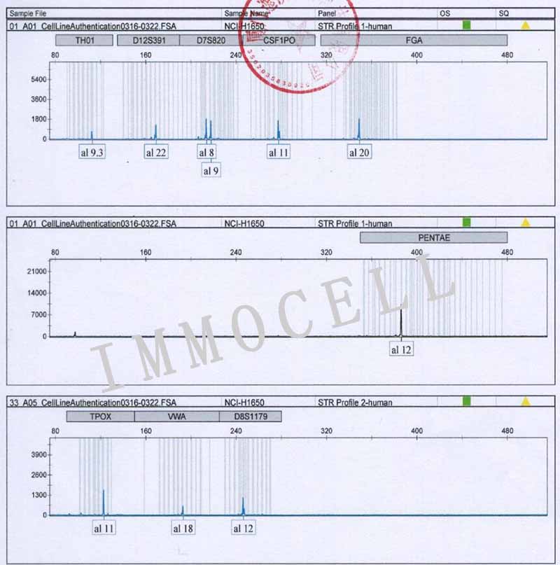 NCI-H1650人非小细胞肺癌细胞STR鉴定图片