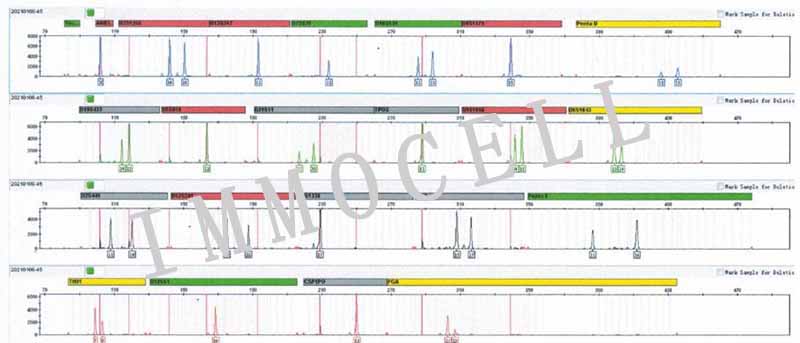NCI-H2228人非小细胞肺癌细胞STR鉴定图片