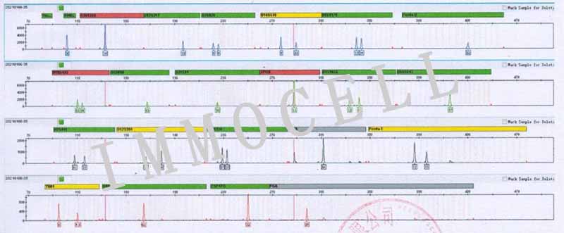 PANC10.05人胰腺癌细胞STR鉴定图片