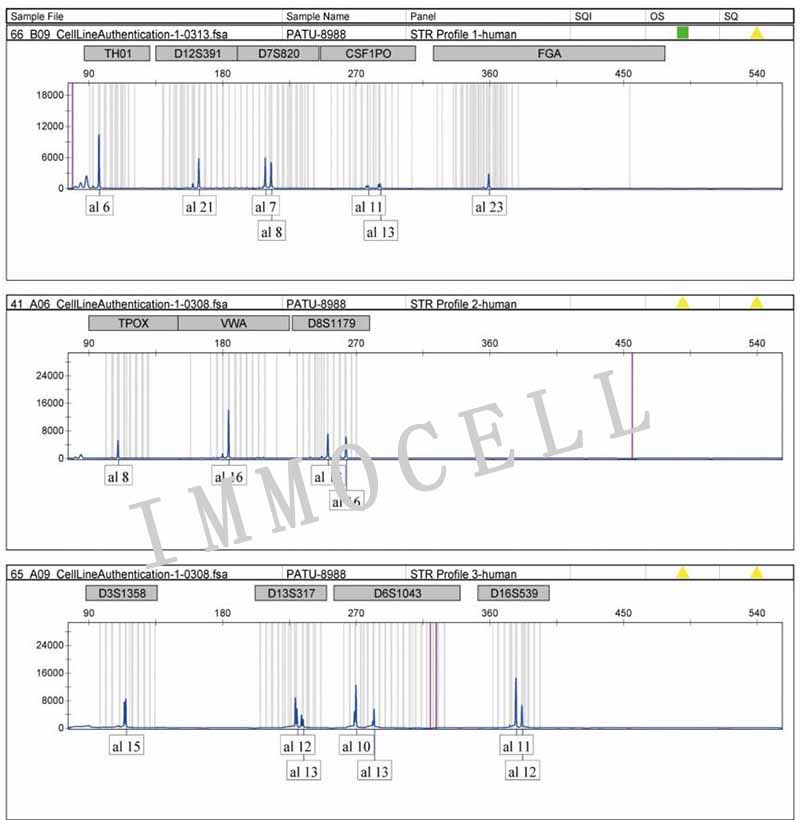 PATU 8988S人胰腺癌细胞STR鉴定图片