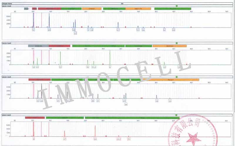 PLC/PRF/5人肝癌亚力山大细胞STR鉴定图片