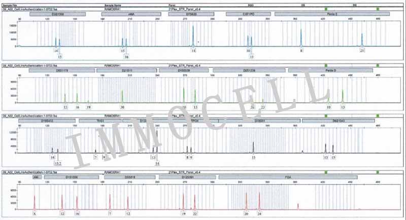 RAMOS人B淋巴细胞瘤细胞STR鉴定图片