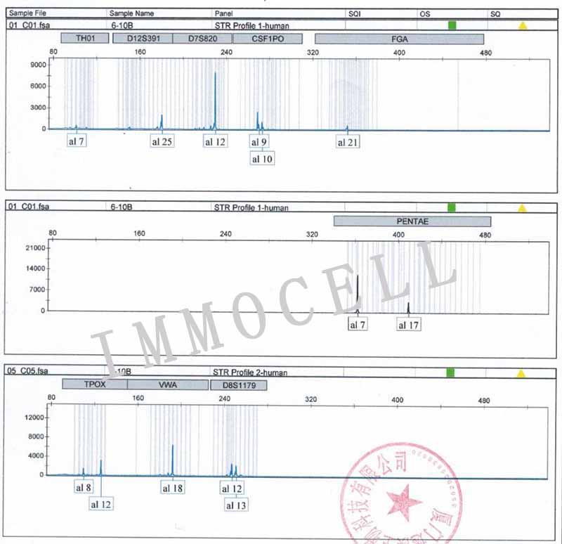 SBC-2人小细胞肺癌细胞STR鉴定图片