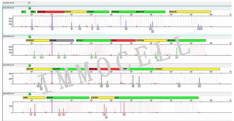 SK-HEP-1人肝癌细胞STR鉴定图片