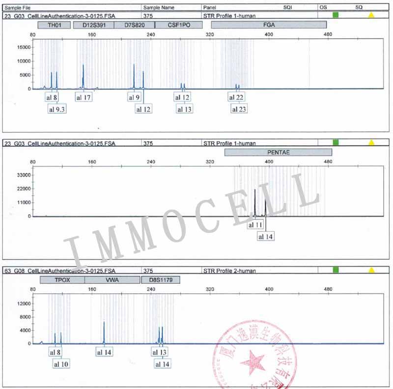 SNU-1人胃癌细胞STR鉴定图片