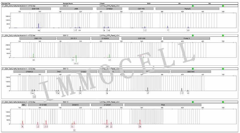 SW-13人肾上腺皮质癌细胞 STR鉴定图片