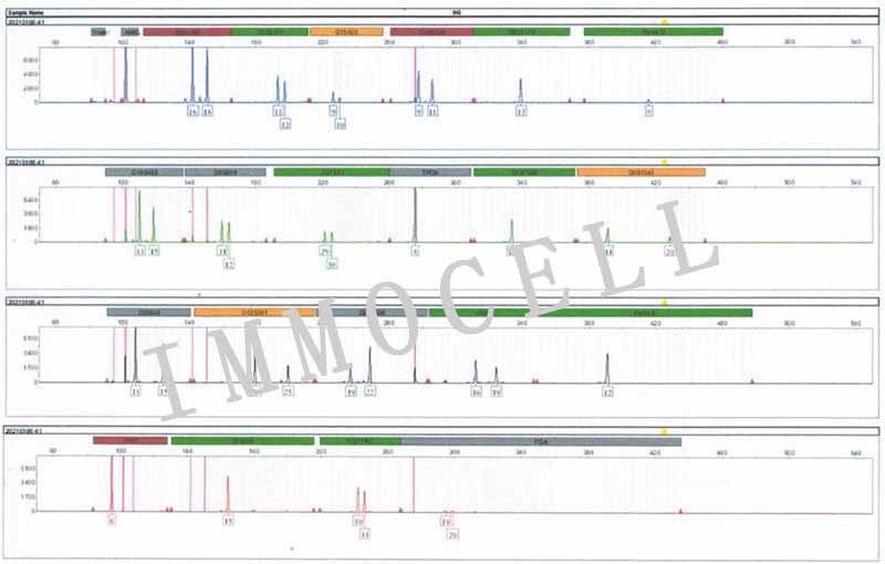 SW-780人膀胱移行细胞癌STR鉴定图片