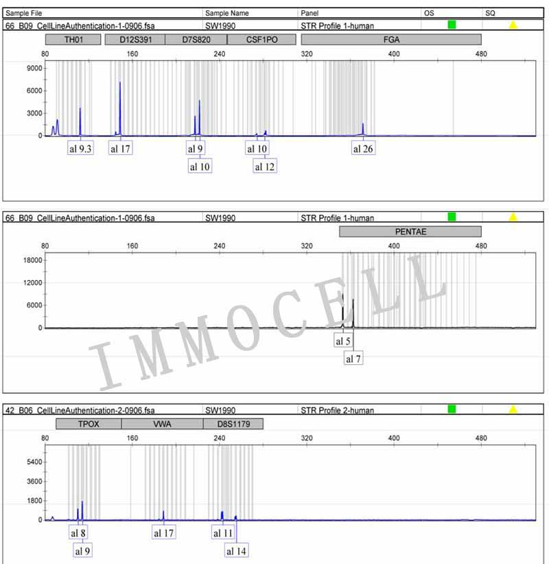 SW1990人胰腺癌细胞STR鉴定图片