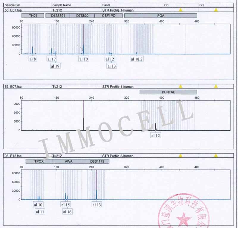 TU212人喉癌细胞STR鉴定图片