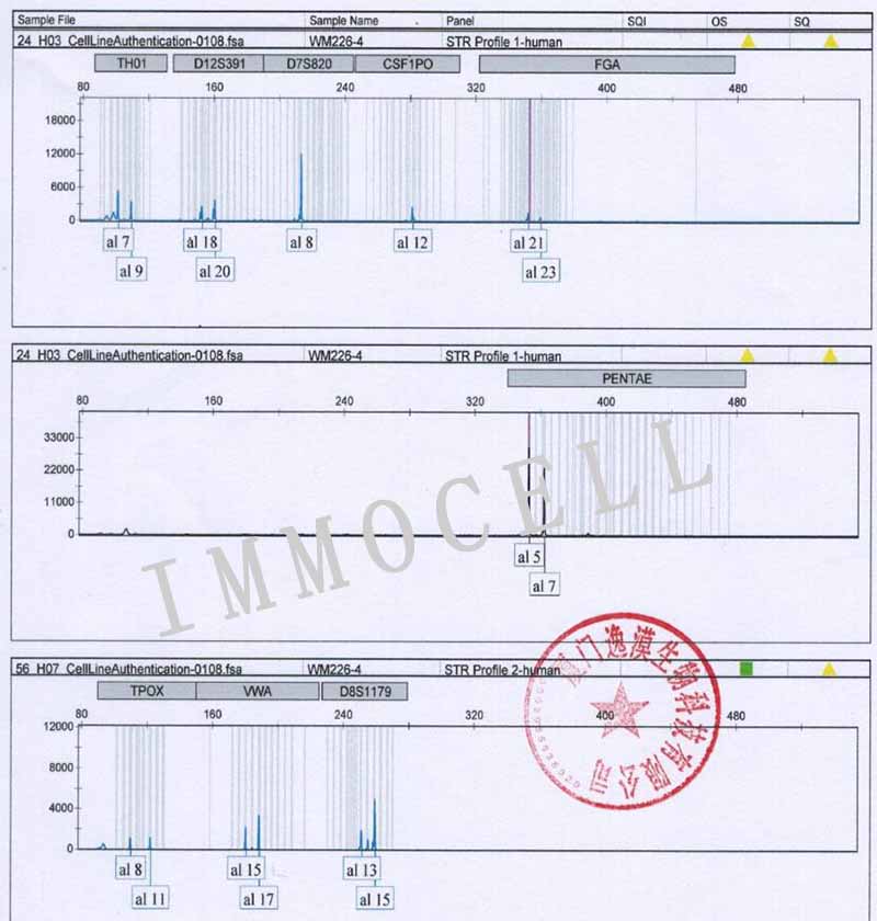 WM-115人恶性黑色素瘤细胞STR鉴定图片