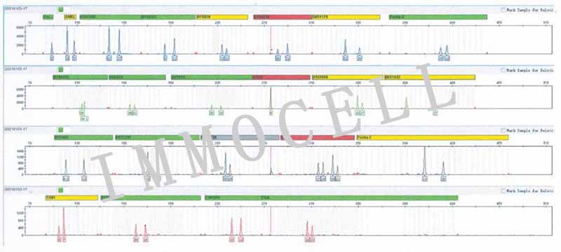 YT人NK细胞白血病细胞STR鉴定图片