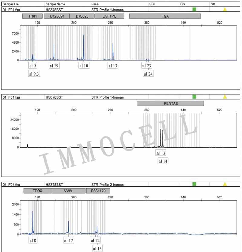 HS578T人乳腺癌细胞STR鉴定图片