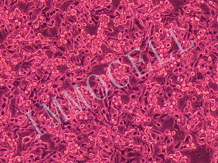 CT26-LUC（小鼠结肠癌细胞-荧光素酶标记）图片
