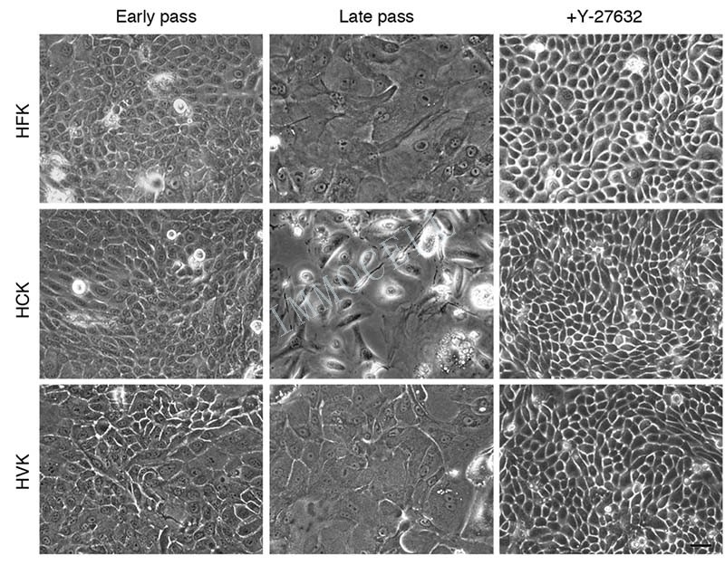 Y-27632处理的角质生成细胞的形态学特征图