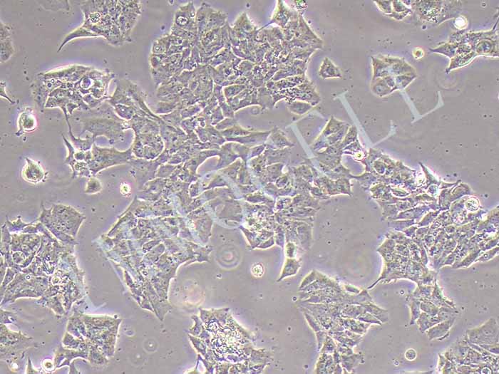 MDA-MB-361细胞图片