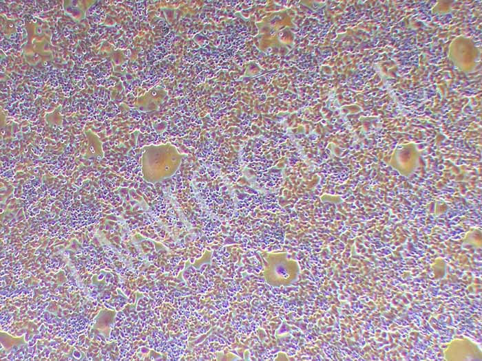 A2780/ Taxol 细胞图片
