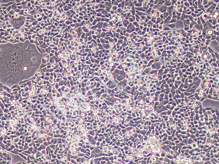A2780/ Taxol 人卵巢癌细胞紫杉醇耐药株图片