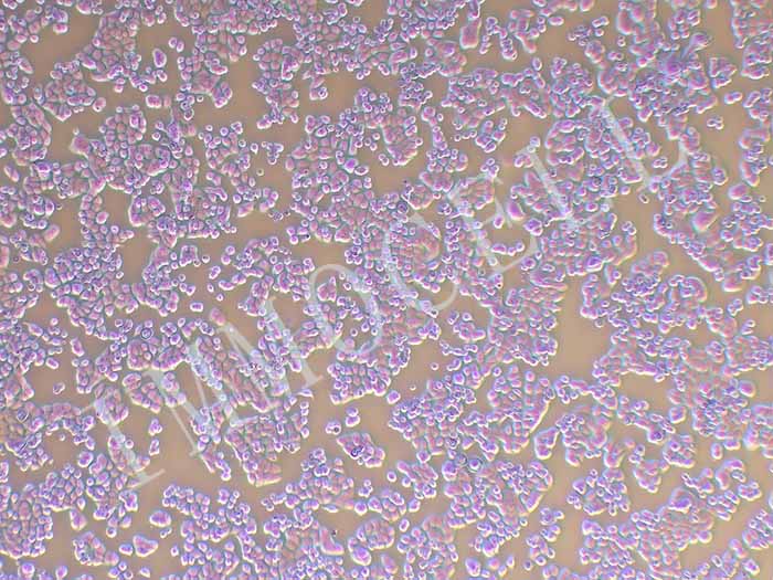 CX-1人结肠癌细胞细胞图片