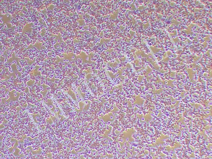 Hkb20细胞细胞图片