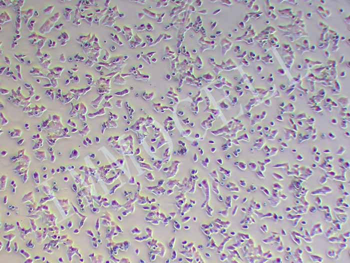 NCI-H295R细胞图片