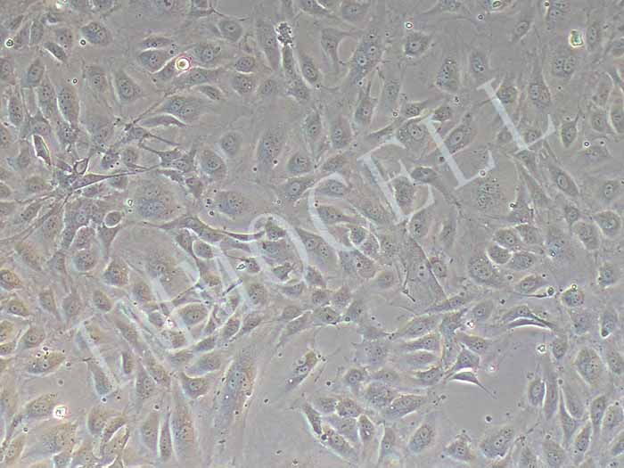 HUVEC细胞图片