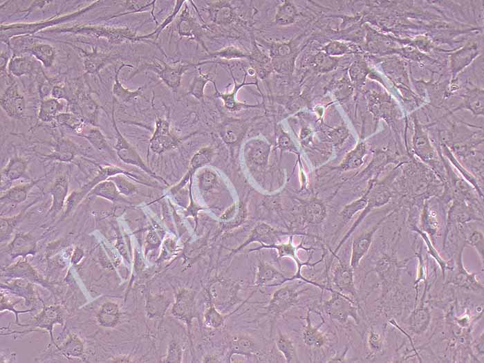 人主动脉瓣膜间质细胞永生化图片