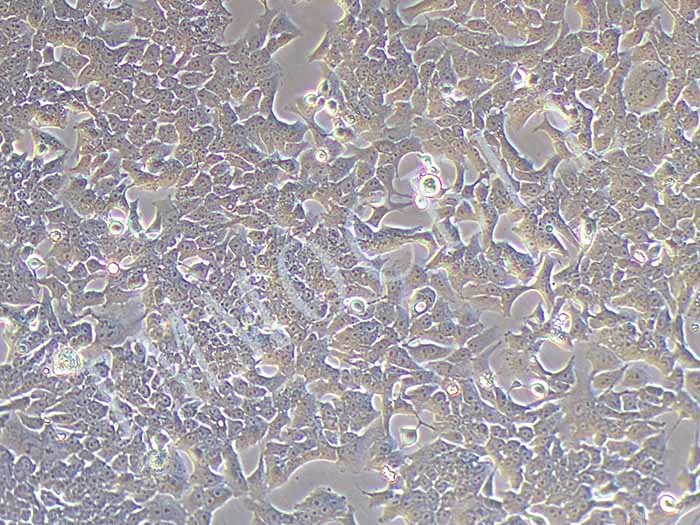BIU-87细胞细胞图片