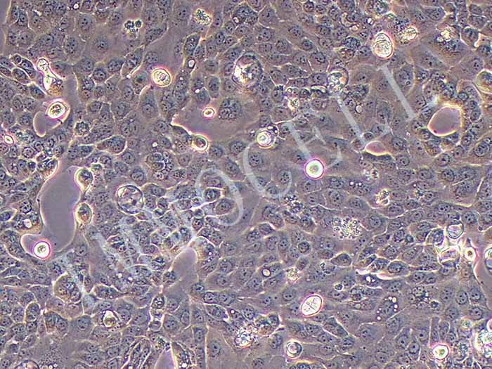 CFPAC-1细胞图片