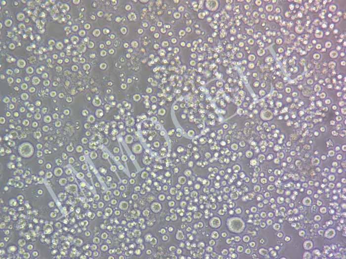 HBL-1-LUC细胞图片