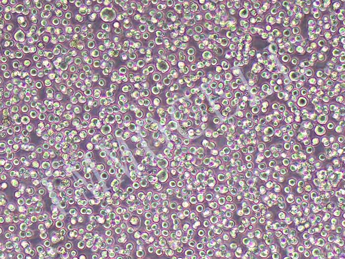 HBL-1细胞图片