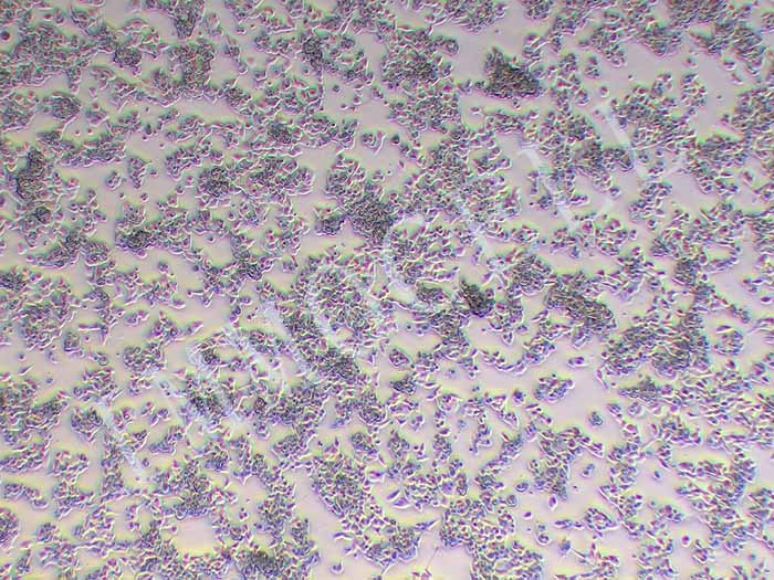 LS174T人肠细胞图片