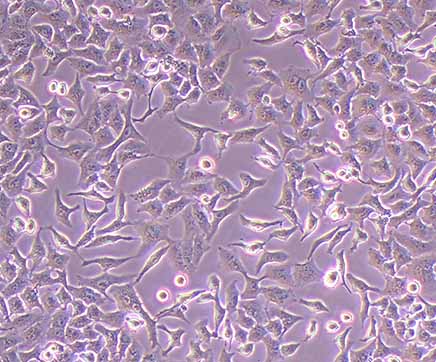 肺癌研究常用细胞系及其优化实验方案