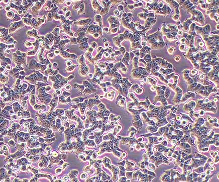 乳腺癌研究常用细胞系及其优化实验方案