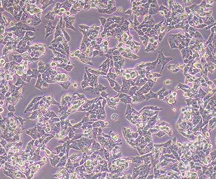 肝癌研究常用细胞系及其优化实验方案