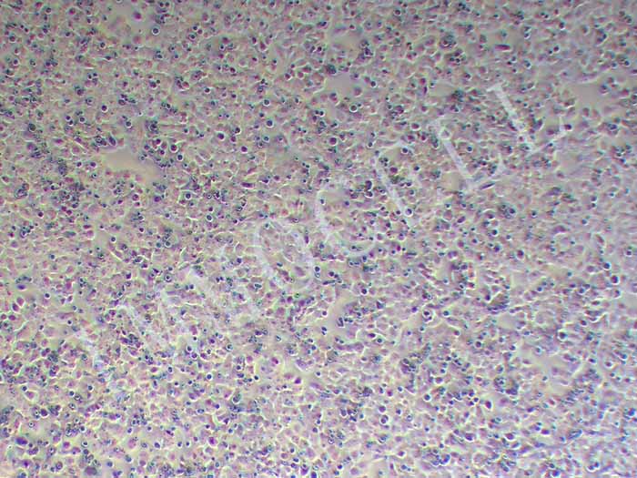 OVCAR-8/ADR细胞图片