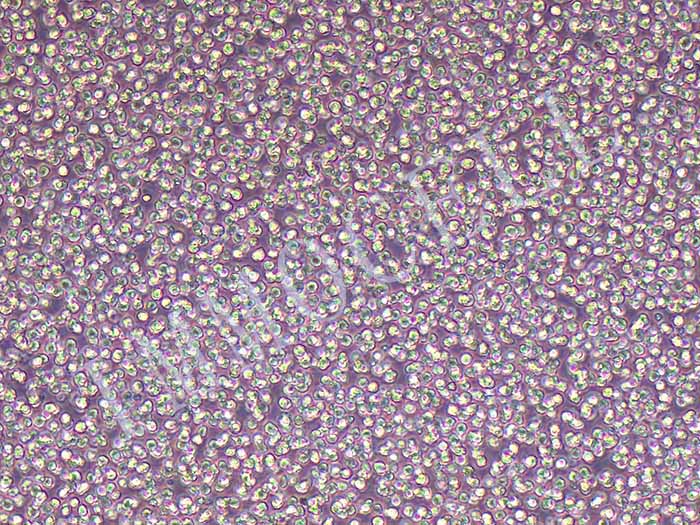 MV4-11-EGFP细胞图片