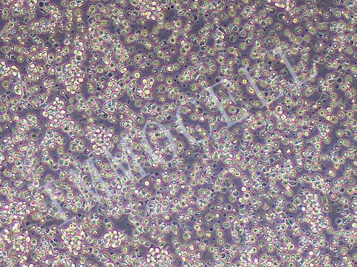 CCRF-CEM细胞图片