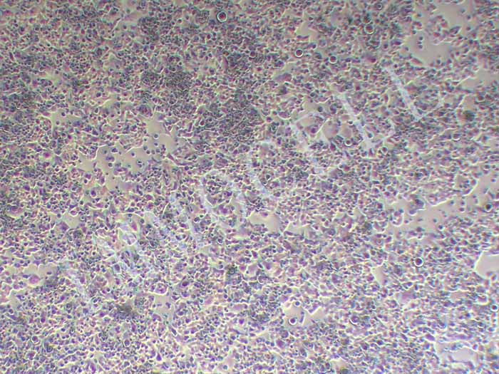 NCI-H520细胞图片