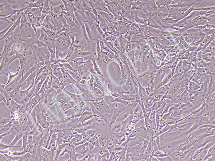 U87MG-LUC细胞图片