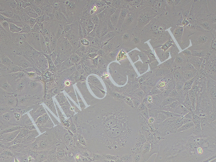 MKN7-LUC细胞图片
