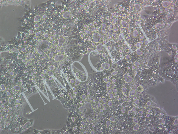 NCI-N87-EGFP-LUC细胞图片
