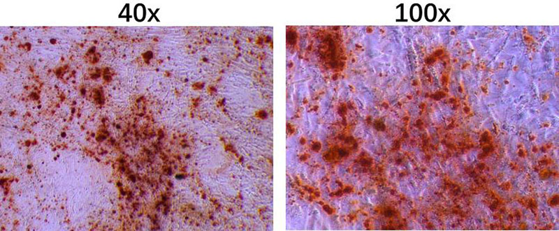 间充质干细胞成骨分化染色效果图