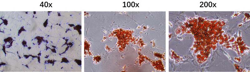 间充质干细胞成脂分化染色效果图