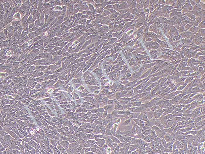 小鼠主动脉血管平滑肌细胞永生化图片