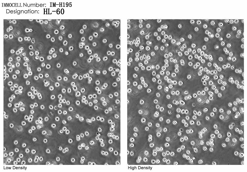 逸漠细胞库HL-60细胞图片